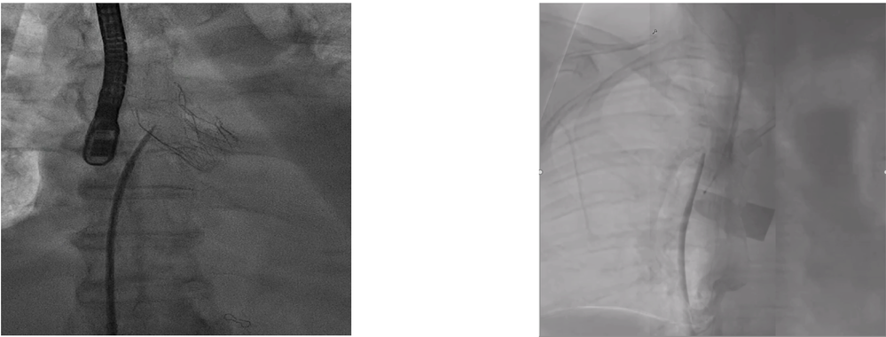 xray.png