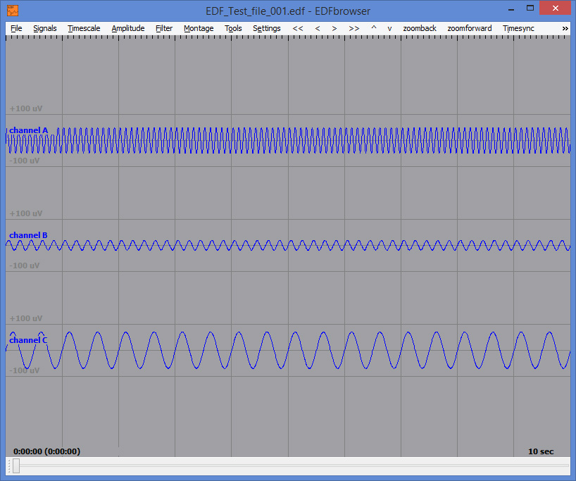 EDF-file-in-EDF-browser.jpg