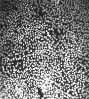 New_Channel_0__B_003_r_0001_c_0002_t_0000_z_0004.png